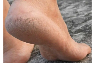 Labor Raspa Calli Grande... 2