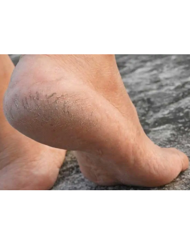 Labor Raspa Calli Grande per piedi morbidi e...