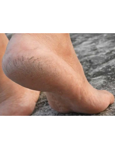 Labor Raspa Calli Grande per piedi morbidi e levigati